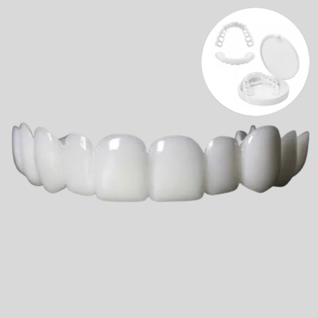 Carillas Snap-On Smile para Mejora de la Sonrisa