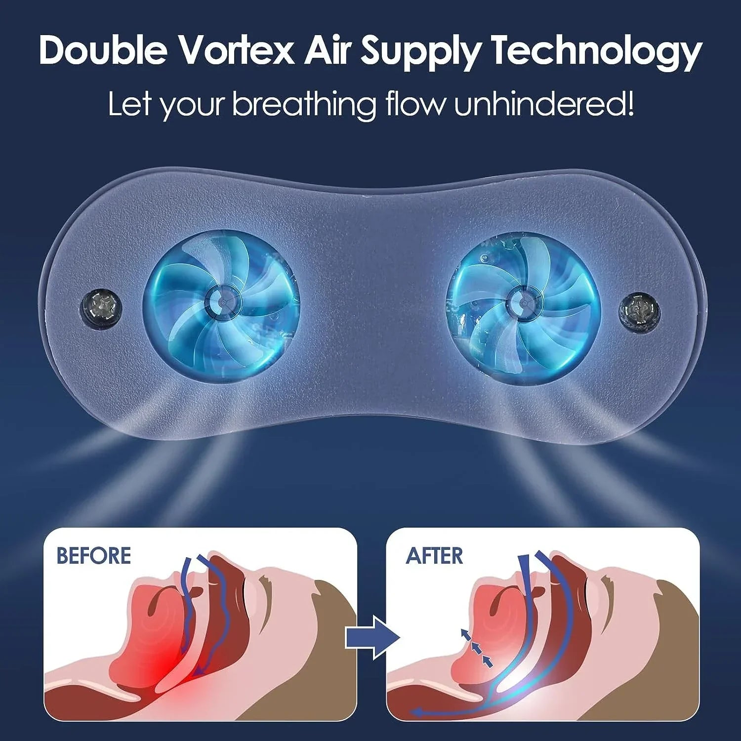 Mikro-CPAP Schlafapnoe-Gerät für Reisen & Anti-Schnarch – CPAP-Alternative