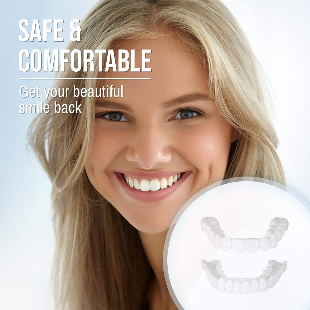 Smile Veneer (Ober- & Unterkiefer Inklusive)