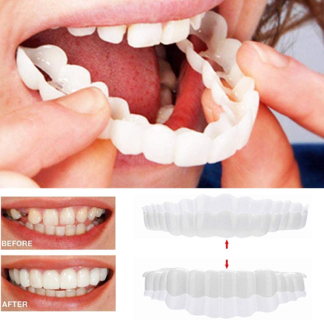 Smile Veneer (Ober- & Unterkiefer Inklusive)