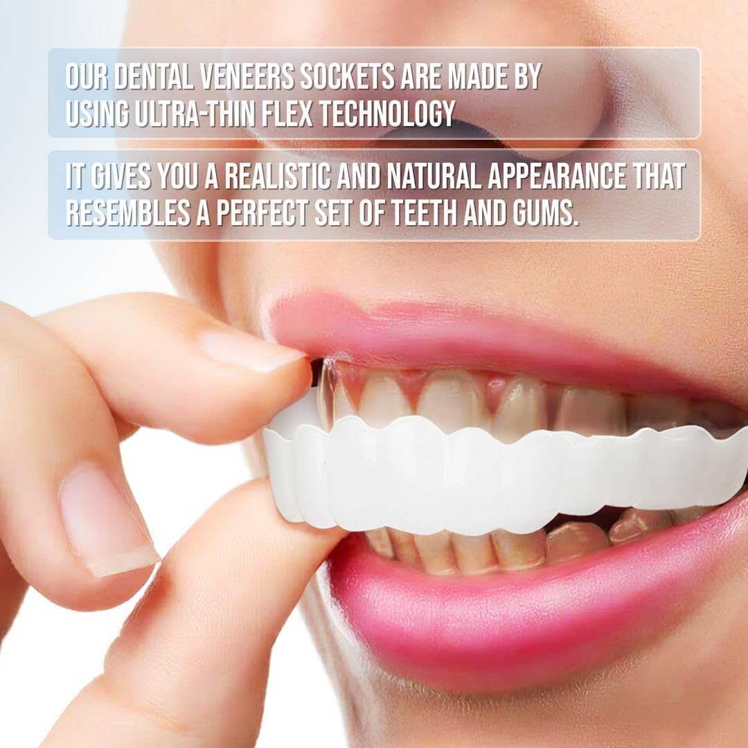Smile Veneer (Ober- & Unterkiefer Inklusive)