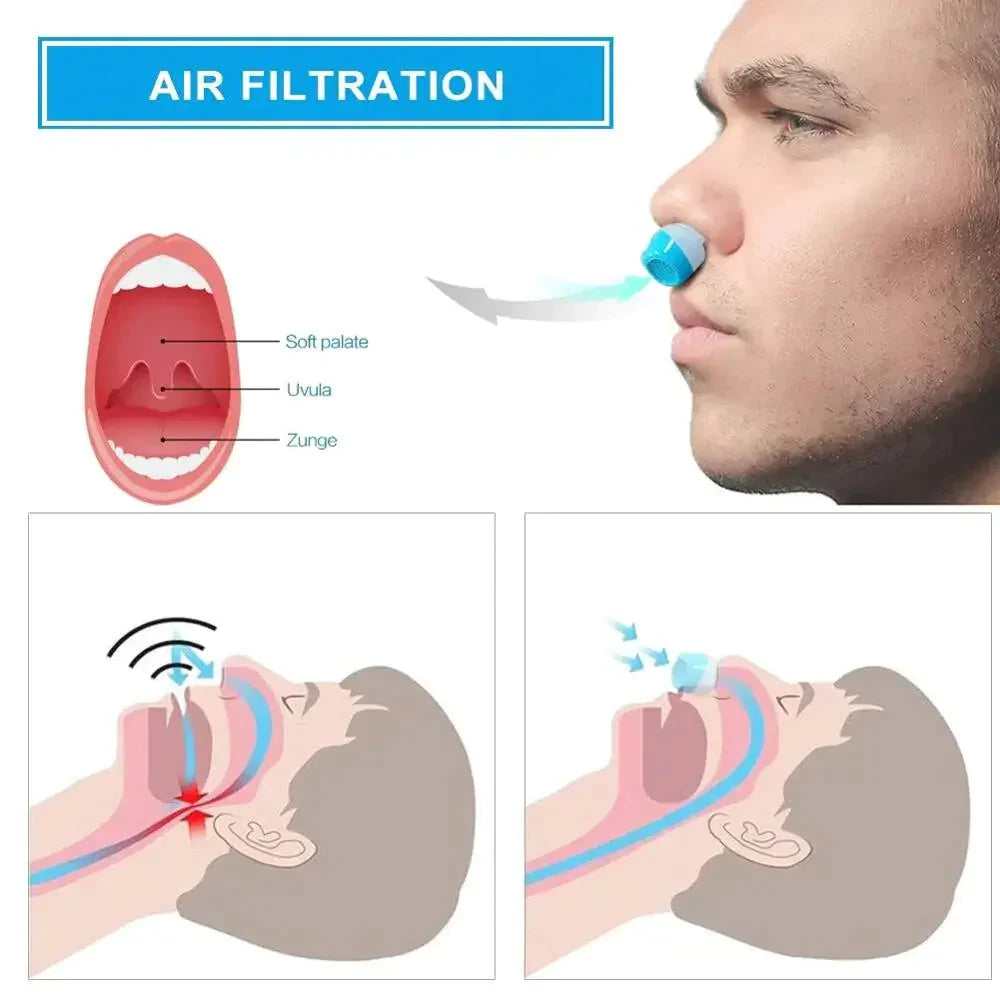 Mikro-CPAP Schlafapnoe-Gerät für Reisen & Anti-Schnarch – CPAP-Alternative