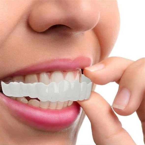 Smile Veneer (Ober- & Unterkiefer Inklusive)