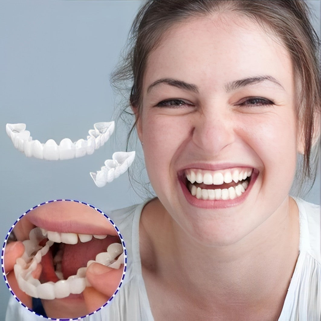 Smile Veneer (Ober- & Unterkiefer Inklusive)