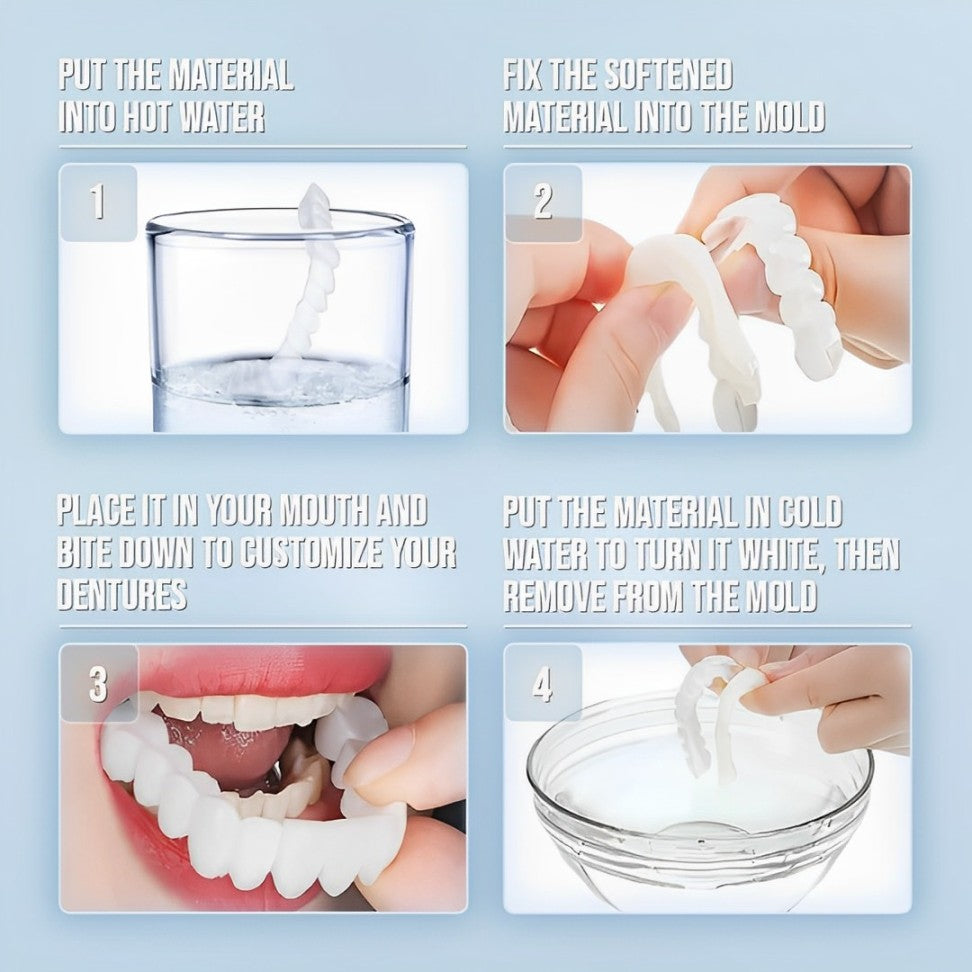 Smile Veneer (Ober- & Unterkiefer Inklusive)