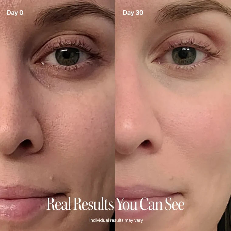 4-in-1 LED Skincare Wand — Red Light Therapy